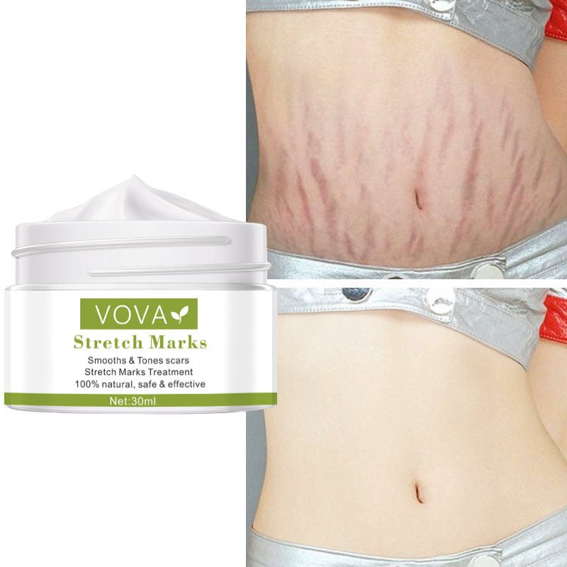 Anti-Stretch Marks Scar Removal Cream