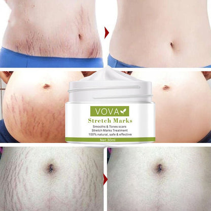 Anti-Stretch Marks Scar Removal Cream