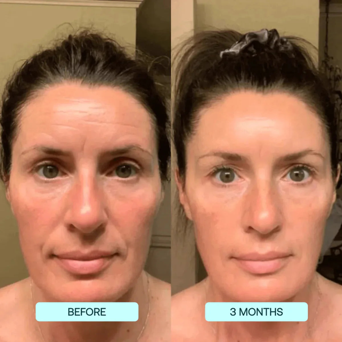 NANO SKIN™  FACE REJUVENATION ANTI AGING FORMULA COLLAGEN FILMS