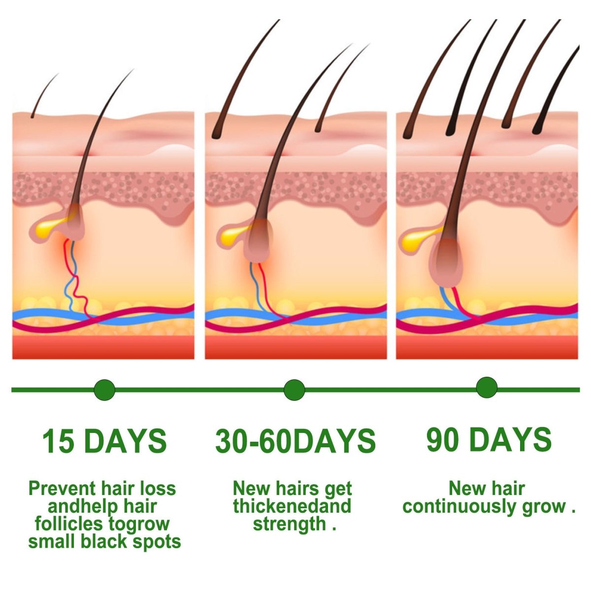 Rosemary Anti-Breakage Nourishing Hair Care Oil (One Free with Therapy Brush)