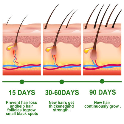 Rosemary Anti-Breakage Nourishing Hair Care Oil (One Free with Therapy Brush)