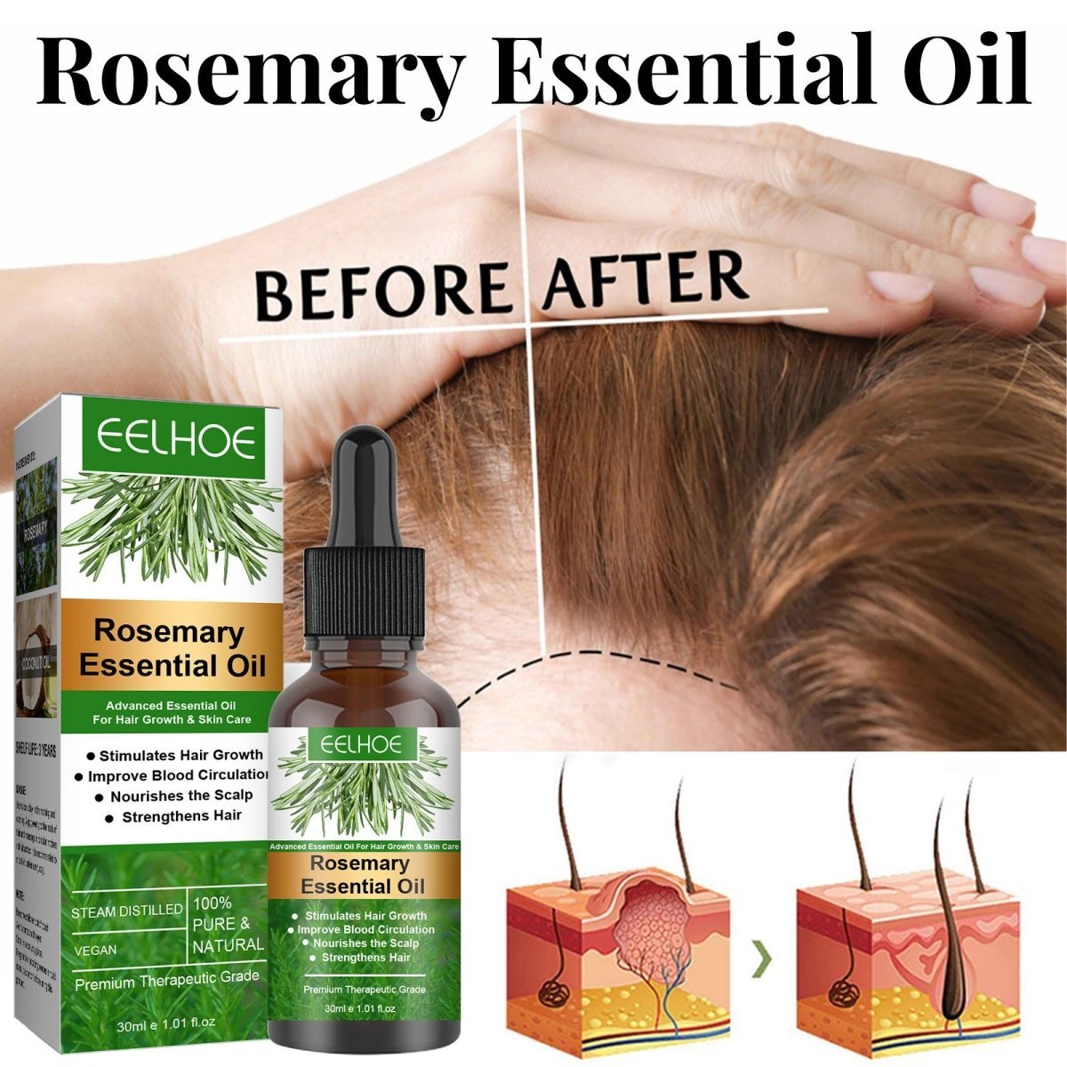 Rosemary Anti-Breakage Nourishing Hair Care Oil (One Free with Therapy Brush)